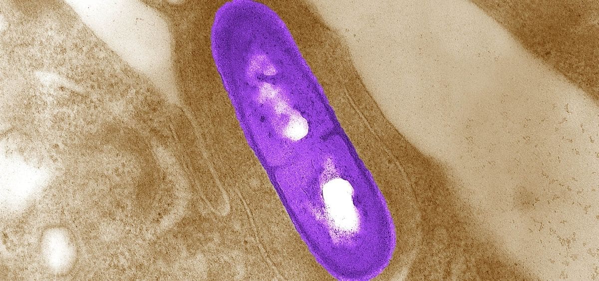 Fotografía al microscopio electrónico de la bacteria causante de la listeriosis