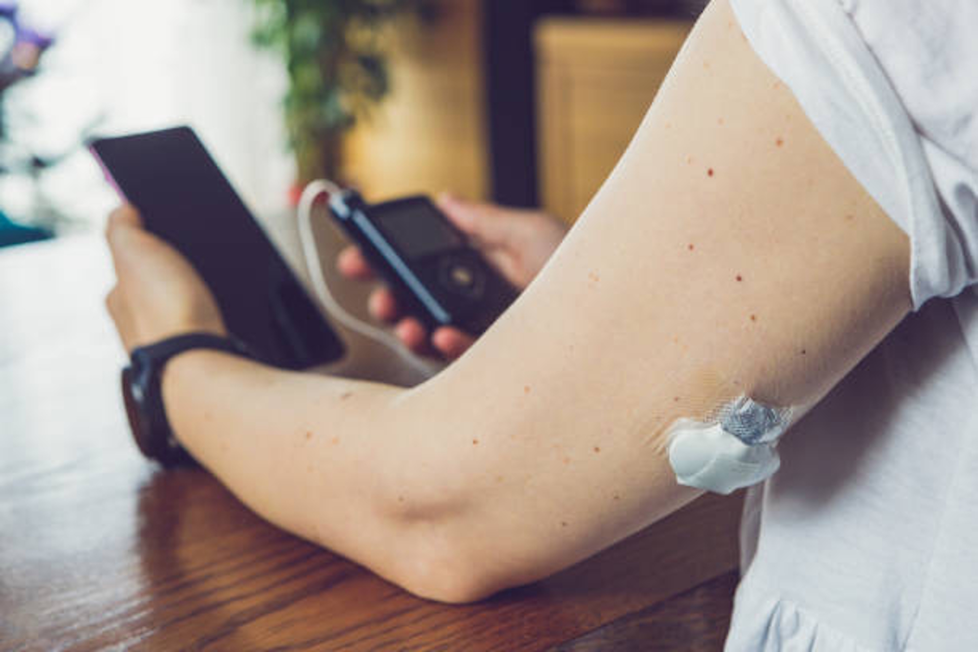 Modern diabetes treatment, woman checking glucose level and dosing insulin using insulin pump and remote sensor on her hand, focus on foreground