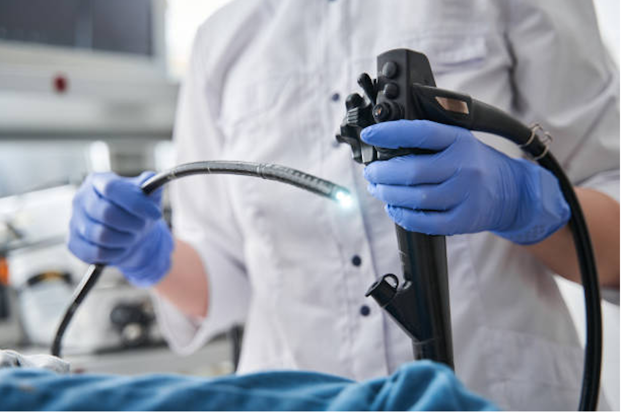 La endoscopia